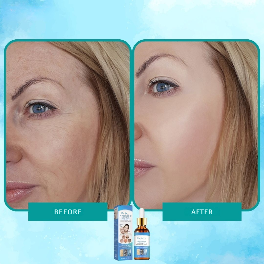 Intenzivní anti-aging elixír botoxového séra 