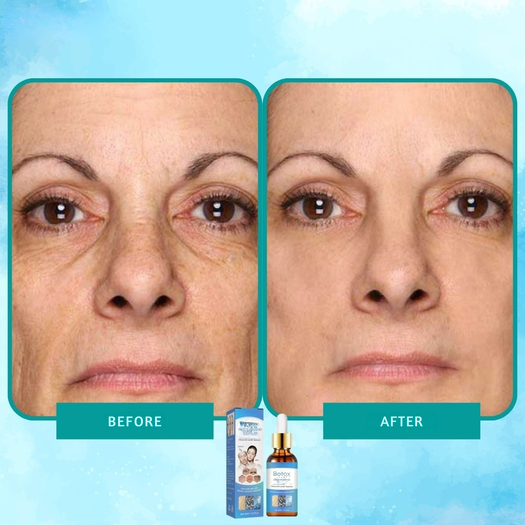 Intenzivní anti-aging elixír botoxového séra 